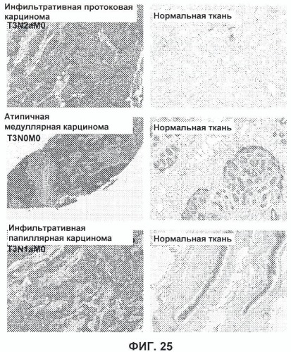 Новые антипролиферативные антитела (патент 2451689)