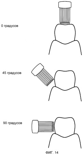 Электрическая зубная щетка (патент 2493760)