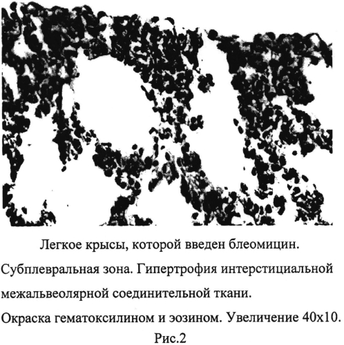 Средство для коррекции нарушений в легочной ткани при цитостатическом воздействии (патент 2554776)