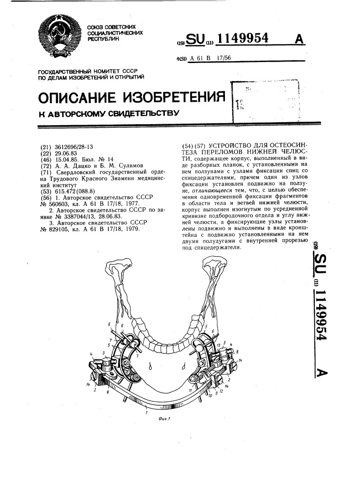 Устройство для остеосинтеза переломов нижней челюсти (патент 1149954)