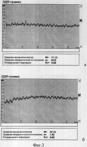 Способ ранней диагностики выраженности корешкового болевого синдрома после дискэктомии (патент 2325104)