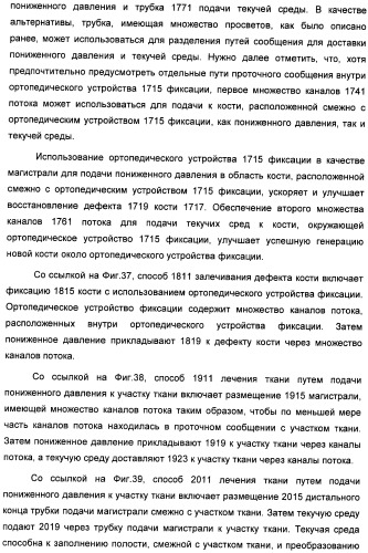 Устройство для лечения путем подкожной подачи пониженного давления с использованием текучей магистрали и связанный с ним способ (патент 2405459)