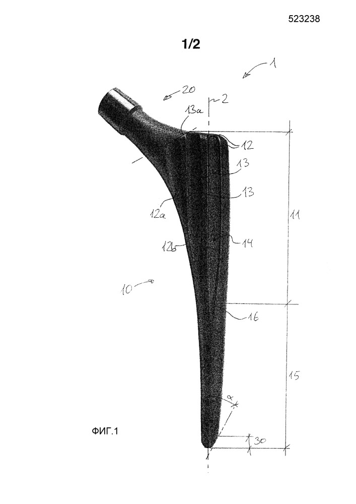 Имплантат сустава (патент 2655878)