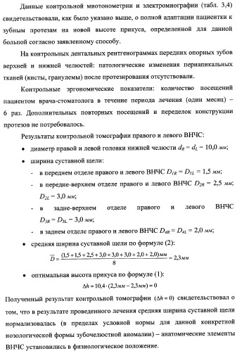 Способ определения оптимальной высоты прикуса (патент 2354300)