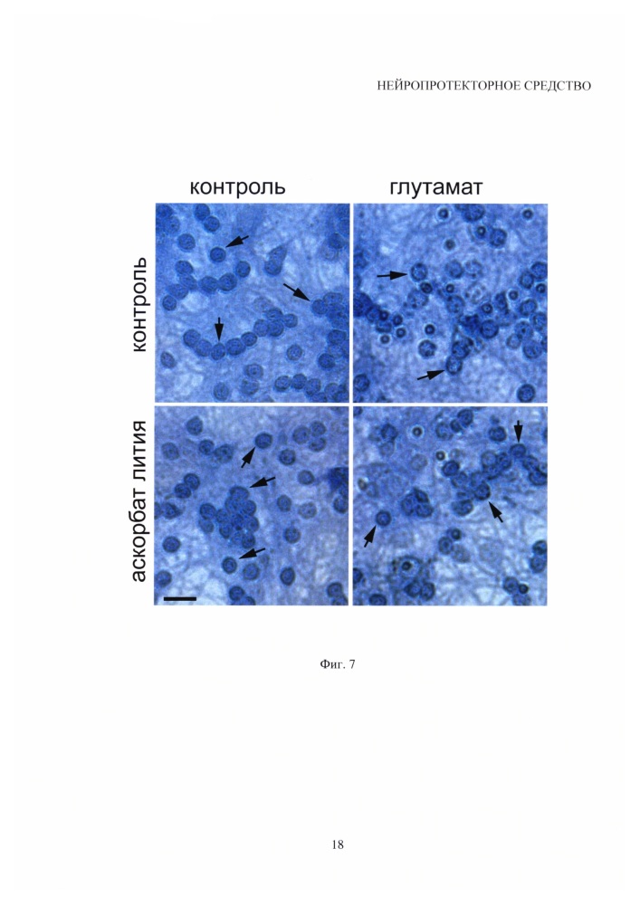 Нейропротекторное средство (патент 2614697)