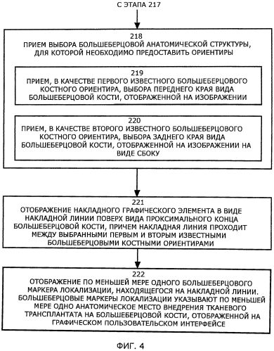 Система для осуществления локализации передней крестообразной связки с применением визуализации (патент 2575055)