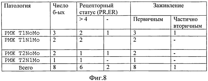 Способ одномоментной мастэктомии и реконструкции молочной железы собственными тканями (патент 2502478)