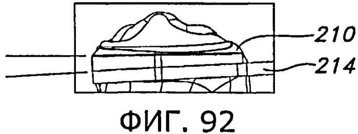 Способы и устройства для артропластики коленного сустава (патент 2583369)