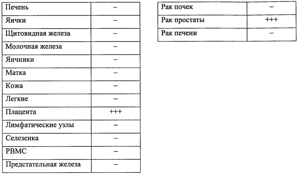 Идентификация опухолеассоциированных антигенов для диагностики и терапии (патент 2644686)