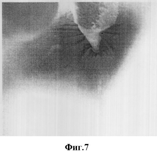 Способ криогенного лечения патологических образований покровных тканей (патент 2308899)