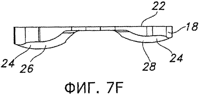 Способы и устройства для артропластики коленного сустава (патент 2570313)