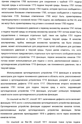 Устройство для лечения путем подкожной подачи пониженного давления с использованием разделения с помощью воздушного баллона (патент 2401652)