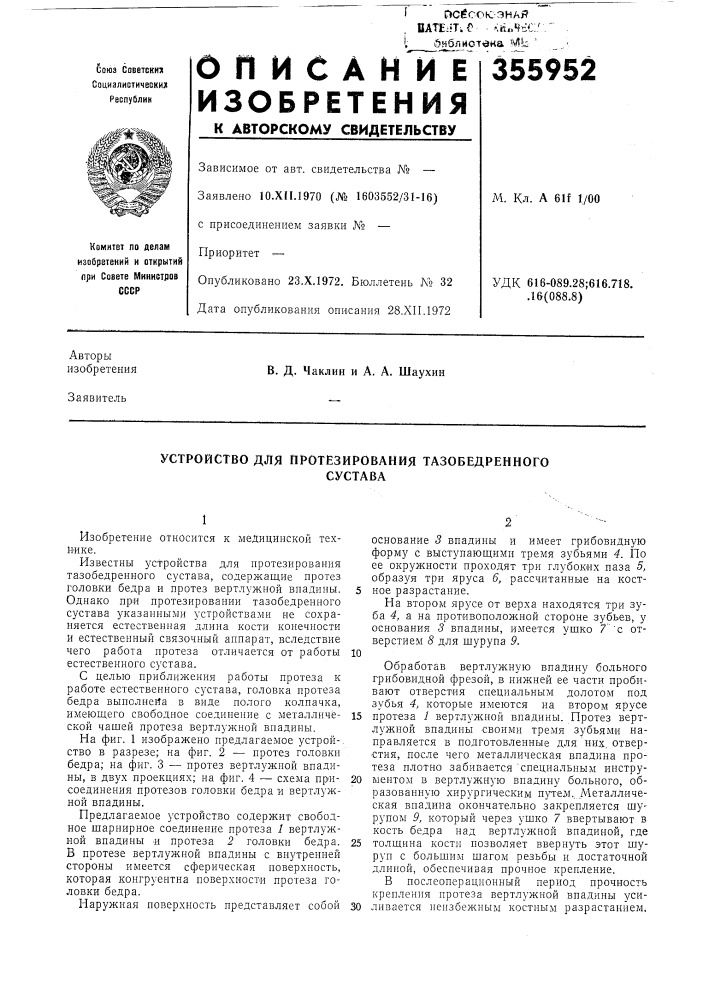 Устройство для протезирования тазобедренногосустава (патент 355952)