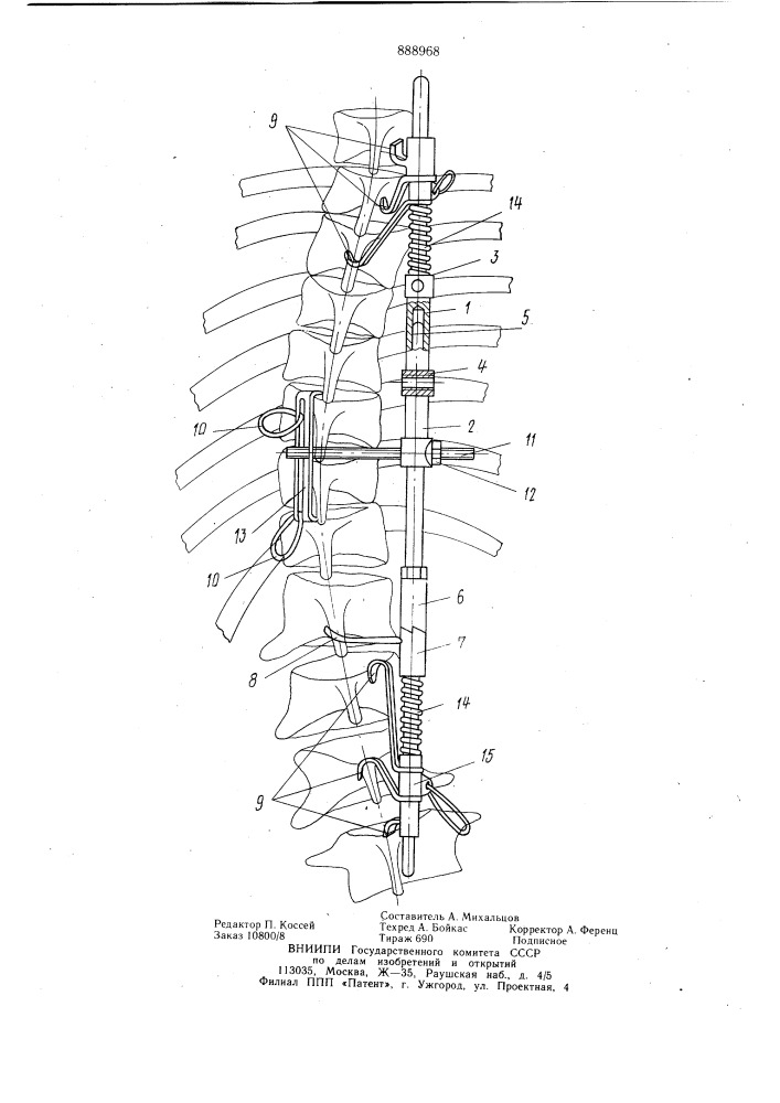 Устройство для коррекции позвоночника (патент 888968)