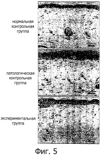 Лечение и/или предотвращение воспаления и фотоповреждения кожи и фотозащита кожи с помощью водорастворимого экстракта растения рода solanum (патент 2541804)