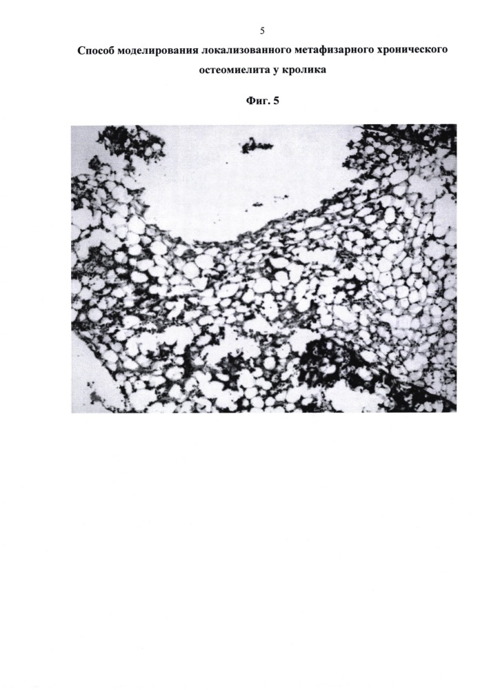 Способ моделирования локализованного метафизарного хронического остеомиелита у кролика (патент 2622209)