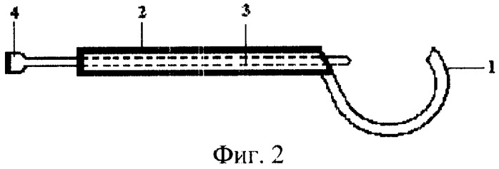 Экстракортикальный фиксатор (патент 2257866)