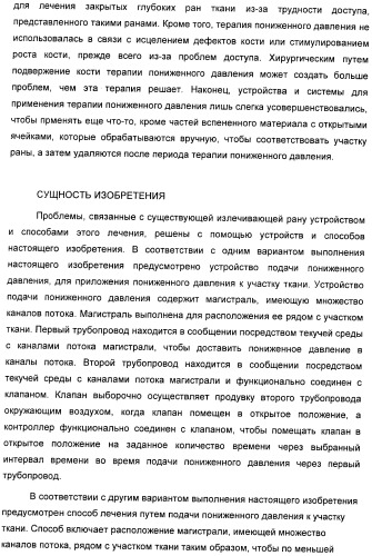 Система и способ продувки устройства пониженного давления во время лечения путем подачи пониженного давления (патент 2404822)