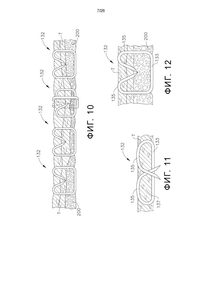 Устройства и способы крепления компенсирующих толщину ткани материалов на хирургических сшивающих инструментах (патент 2635319)