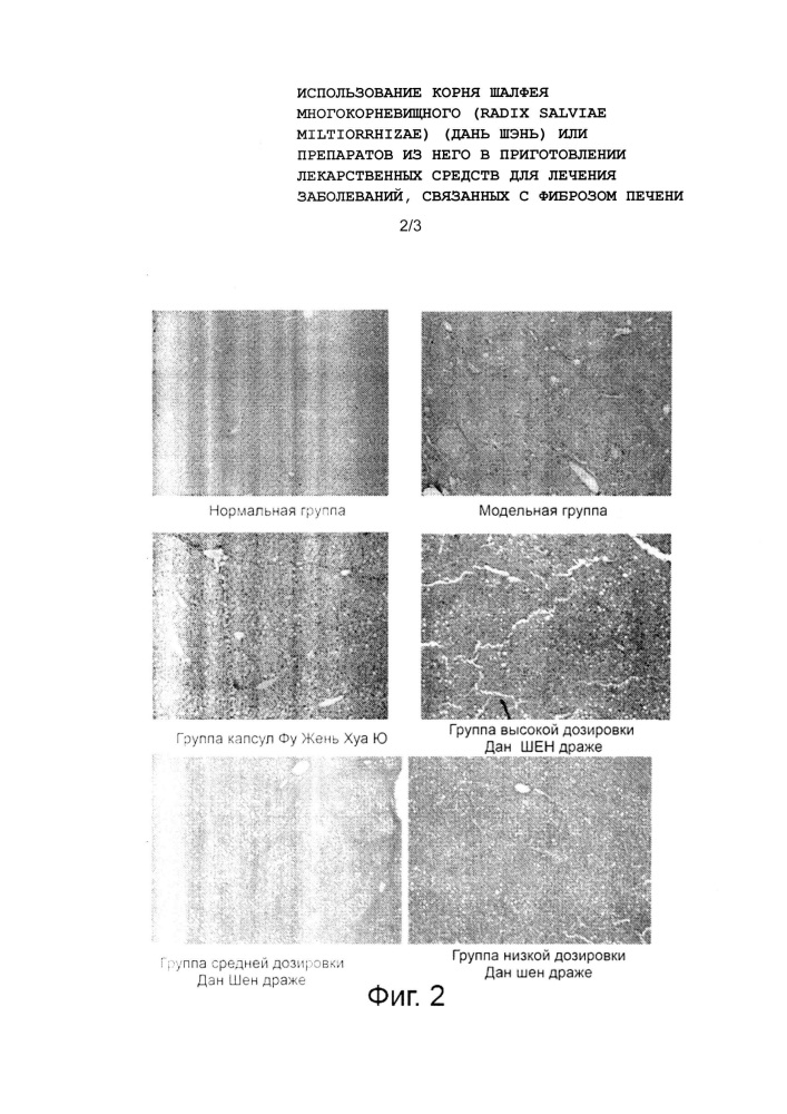 Использование корня шалфея многокорневищного (radix salviae miltiorrhizae) (дань шэнь) или препаратов из него в приготовлении лекарственных средств для лечения заболеваний, связанных с фиброзом печени (патент 2623147)