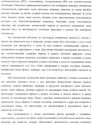 Имплантаты для создания соединений с тканями, в частности со скелетом, а также устройство и способ имплантации (патент 2314768)