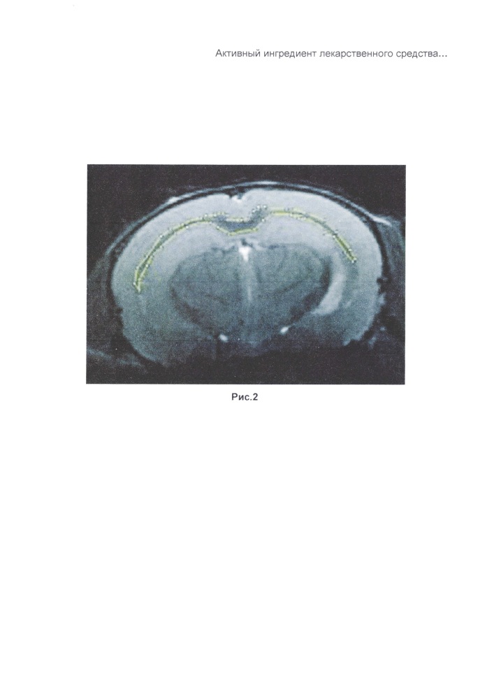 Активный ингредиент лекарственного средства, лекарственное средство, фармацевтическая композиция и способ лечения демиелинизирующих заболеваний живого организма, включая профилактику заболевания (патент 2631887)