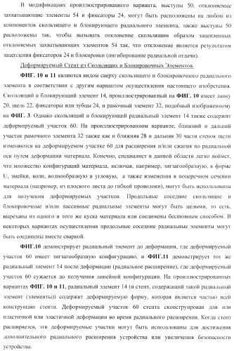 Стент из скользящих и блокирующих элементов (патент 2429801)