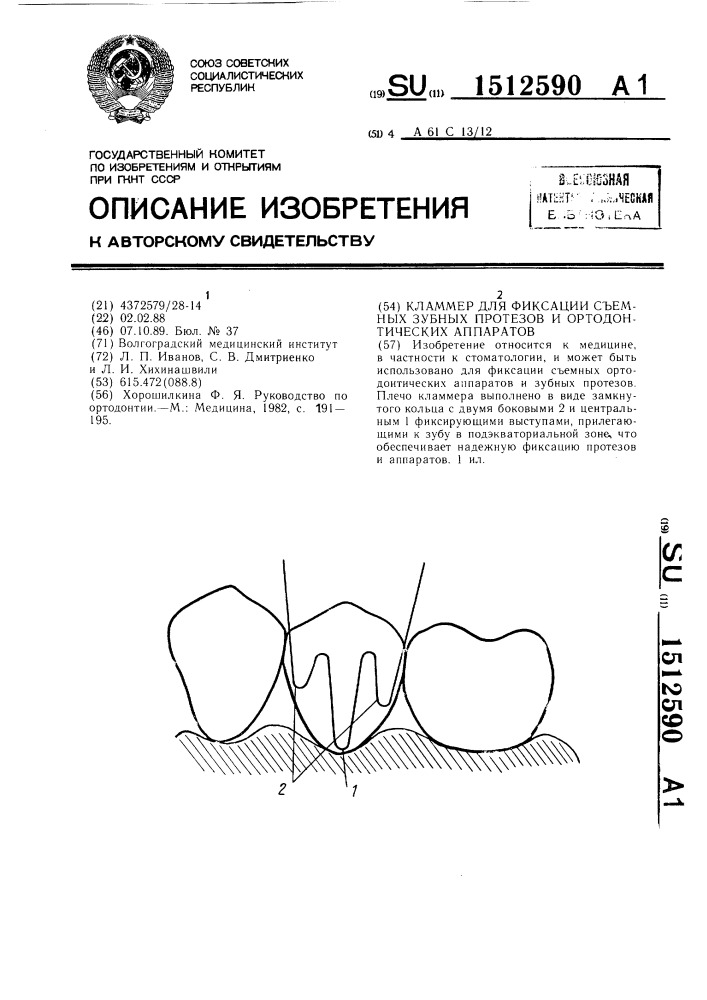 Кламмер для фиксации съемных зубных протезов и ортодонтических аппаратов (патент 1512590)