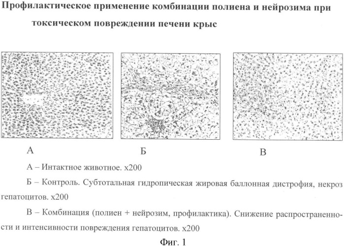 Способ уменьшения токсического повреждения печени (патент 2342132)