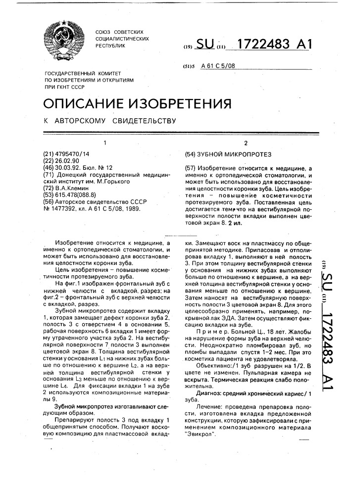 Зубной микропротез (патент 1722483)