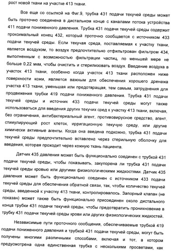 Система и способ продувки устройства пониженного давления во время лечения путем подачи пониженного давления (патент 2404822)