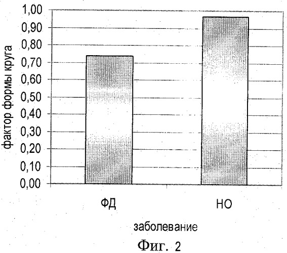 Способ оценки гипопластических состояний костной ткани (патент 2340894)