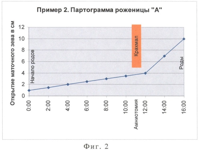 Способ лечения слабости родовой деятельности (патент 2407534)