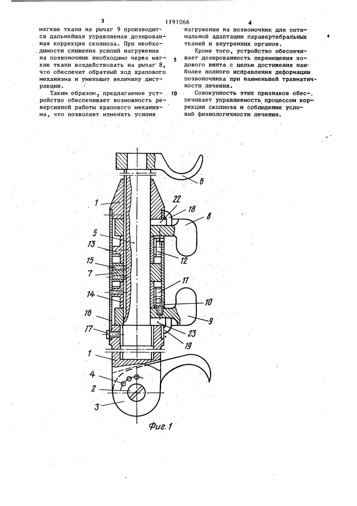 Устройство для коррекции и фиксации позвоночника при лечении сколиозов (патент 1191066)