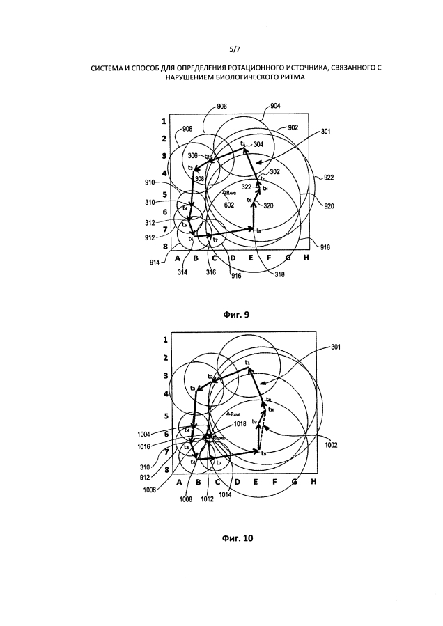 Система и способ для определения ротационного источника, связанного с нарушением биологического ритма (патент 2593892)