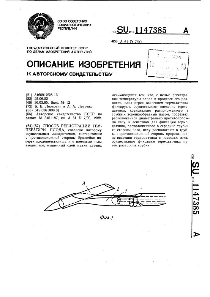 Способ регистрации температуры плода (патент 1147385)