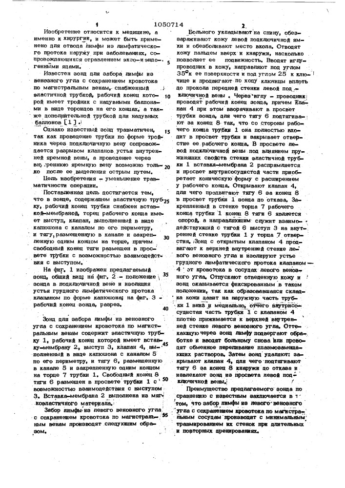 Зонд для забора лимфы из венозного угла с сохранением провотока по магистральным венам (патент 1050714)