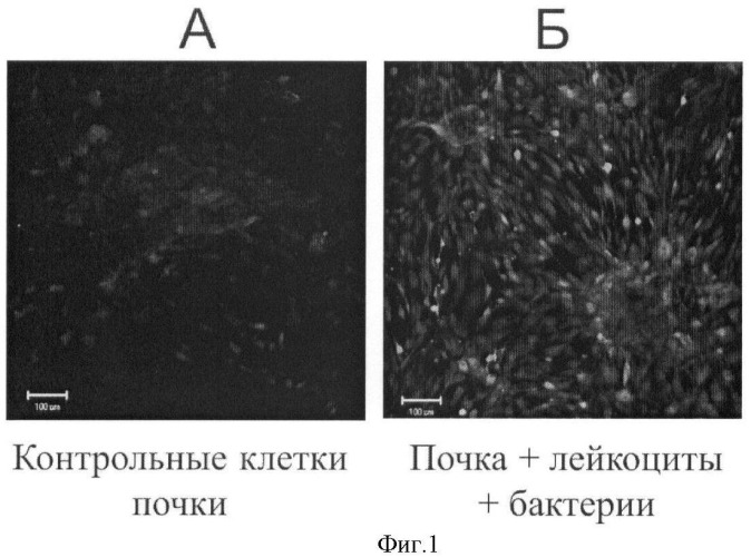 Модельная тест-система для проверки эффективности воздействия на воспалительный процесс в почечной ткани (патент 2425425)