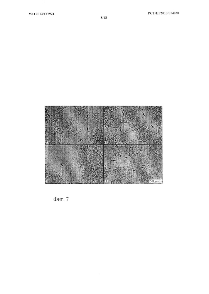 3d in vitro двухфазный костно-хрящевой конструкт (патент 2615439)