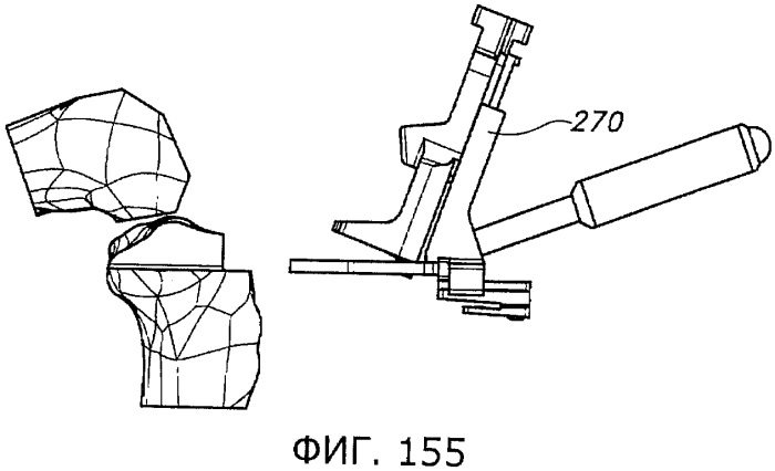Способы и устройства для артропластики коленного сустава (патент 2570163)