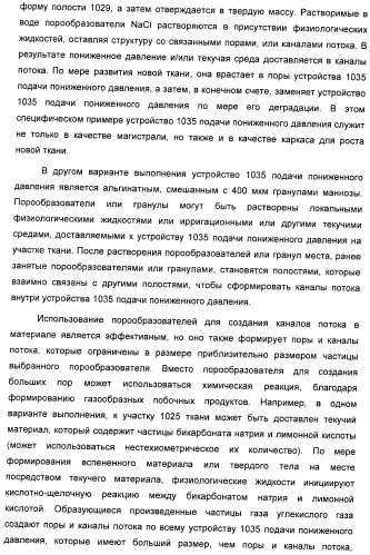 Система и способ продувки устройства пониженного давления во время лечения путем подачи пониженного давления (патент 2404822)