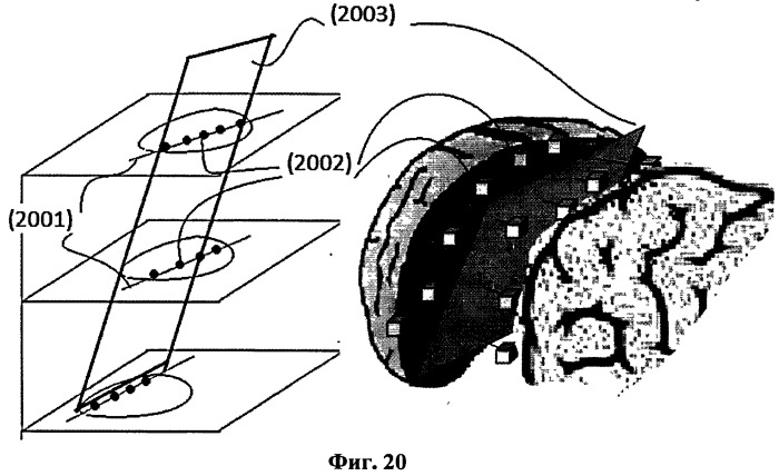 Система и способ для автоматического планирования видов в объемных изображениях мозга (патент 2523929)