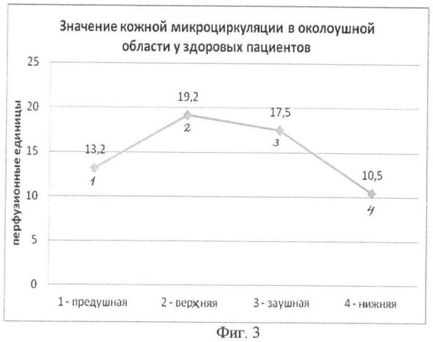 Способ определения кожной микроциркуляции в околоушной области у больных с врожденными пороками уха и приобретенными деформациями ушной раковины (патент 2462994)