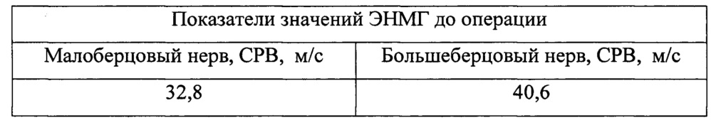 Способ определения целевой артерии для хирургической реваскуляризации больных с критической ишемией нижних конечностей (патент 2654415)