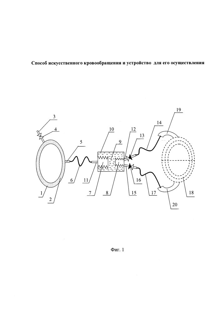 Способ искусственного кровообращения и устройство для его осуществления (патент 2633947)