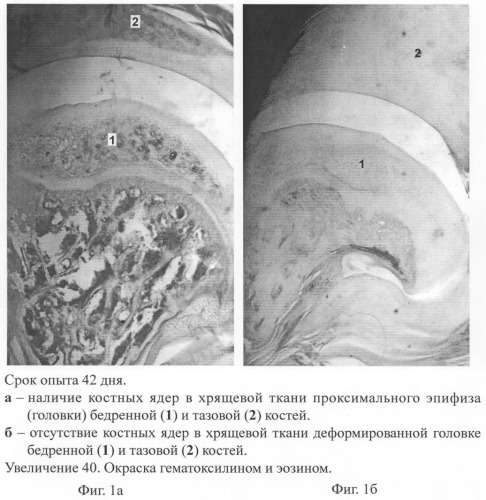 Способ моделирования аномалии бедренной и тазовой костей (патент 2279144)