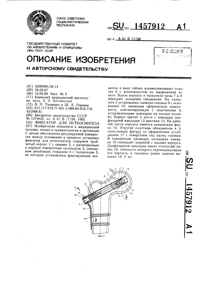 Фиксатор для остеосинтеза (патент 1457912)