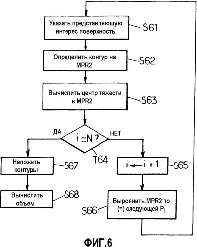 Способ составления и вычисления объема в системе ультразвуковой визуализации (патент 2508056)