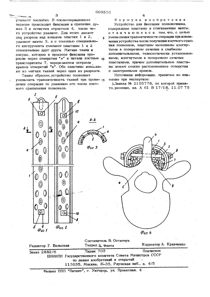 Устройство для фиксации позвоночника (патент 609536)