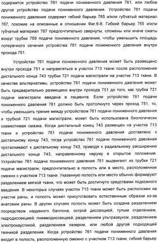 Способ лечения путем подкожной подачи пониженного давления с использованием разделения с помощью воздушного баллона (патент 2405588)